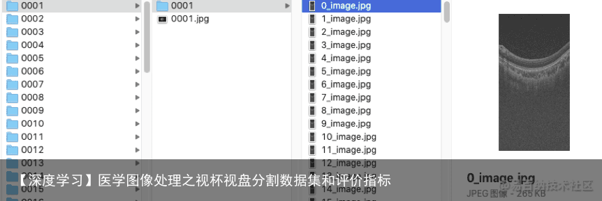 【深度学习】医学图像处理之视杯视盘分割数据集和评价指标