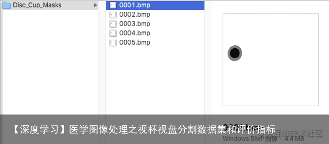 【深度学习】医学图像处理之视杯视盘分割数据集和评价指标