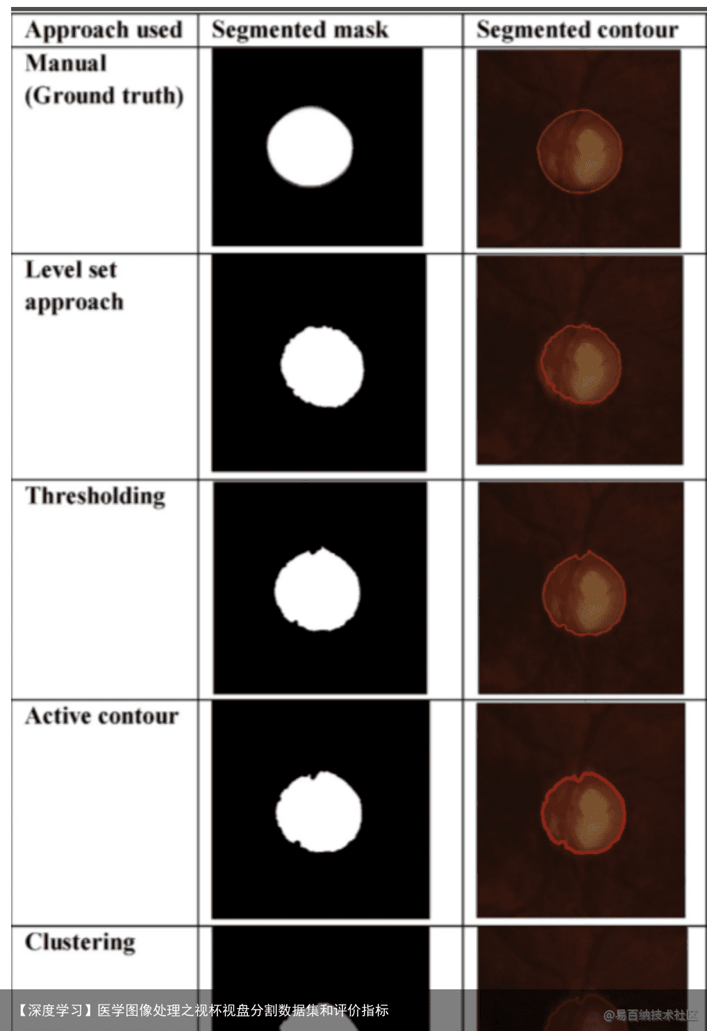 【深度学习】医学图像处理之视杯视盘分割数据集和评价指标