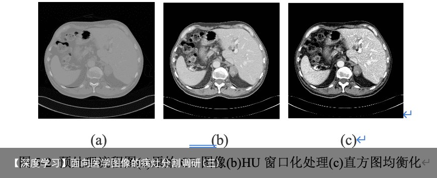 【深度学习】面向医学图像的病灶分割调研(三)2