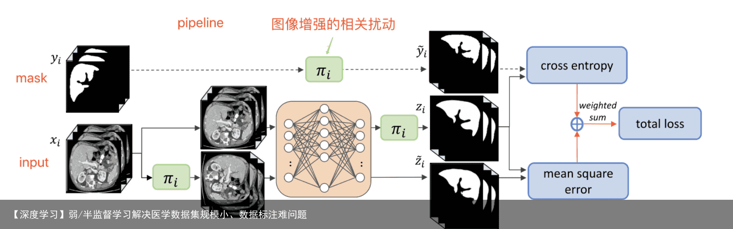 【深度学习】弱/半监督学习解决医学数据集规模小、数据标注难问题