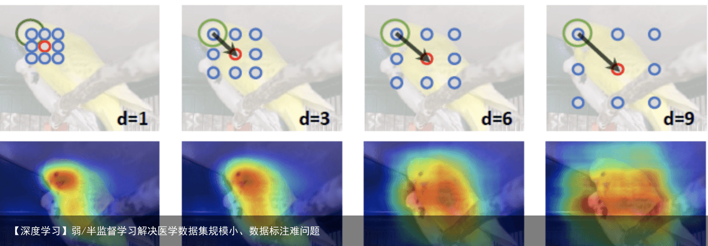 【深度学习】弱/半监督学习解决医学数据集规模小、数据标注难问题