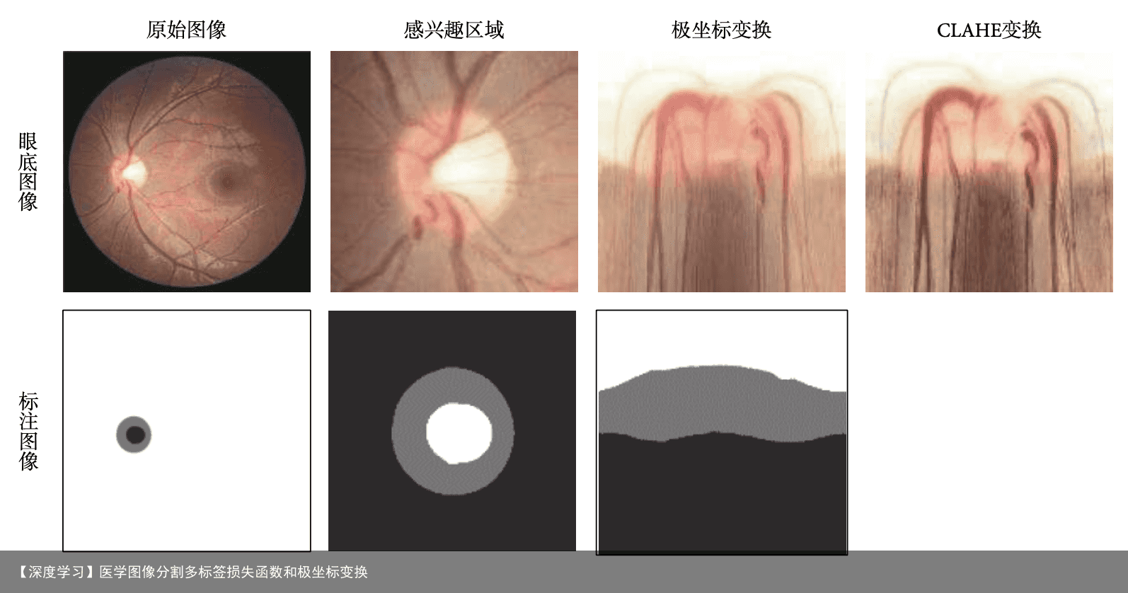 【深度学习】医学图像分割多标签损失函数和极坐标变换