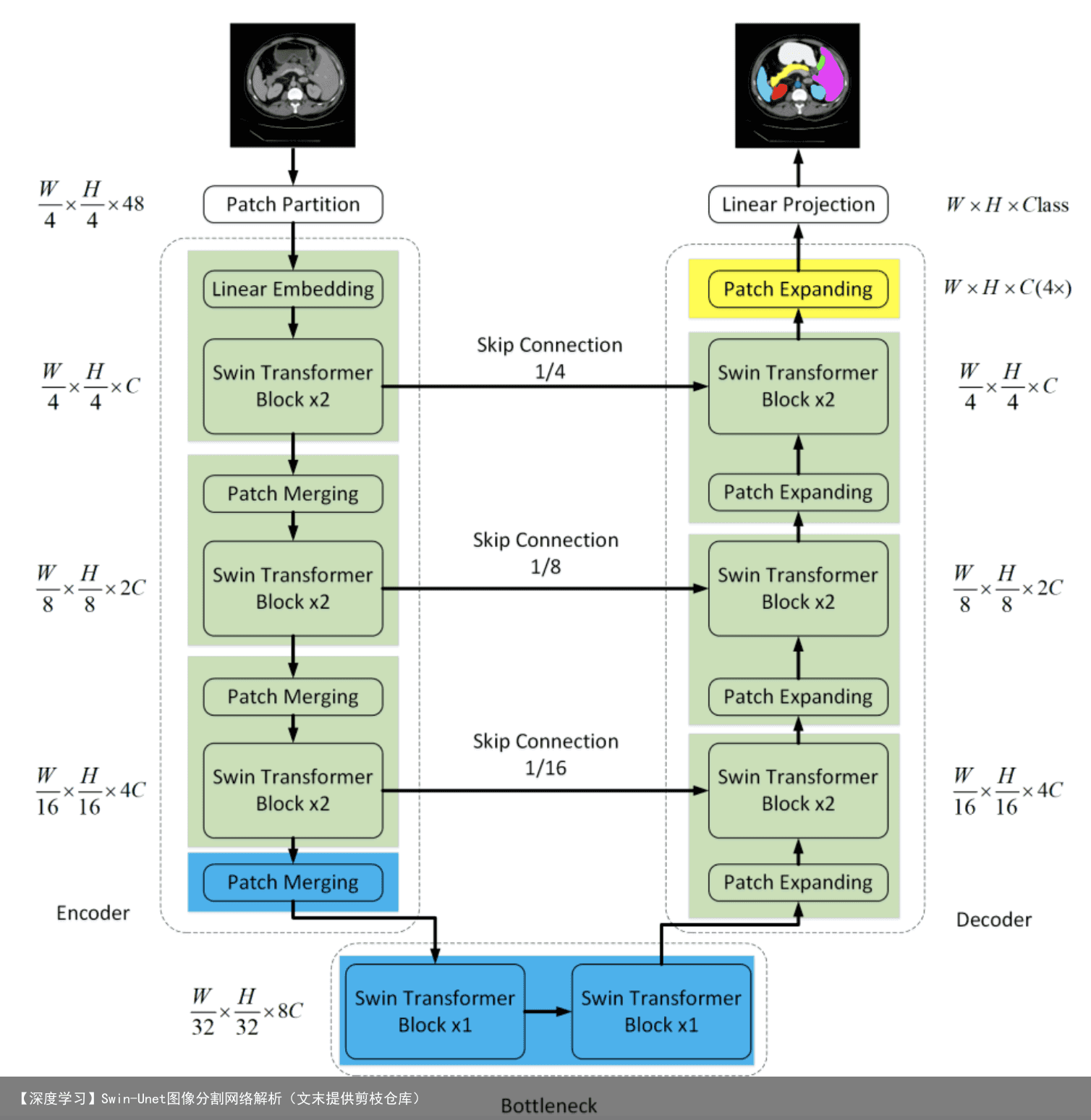 【深度学习】Swin-Unet图像分割网络解析（文末提供剪枝仓库）2
