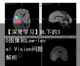 【深度学习】DL下的3D图像和Low-level Vision问题解析10
