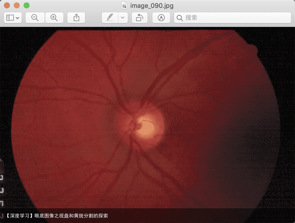 【深度学习】眼底图像之视盘和黄斑分割的探索