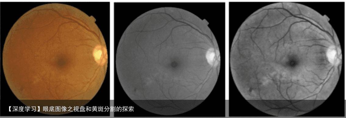 【深度学习】眼底图像之视盘和黄斑分割的探索