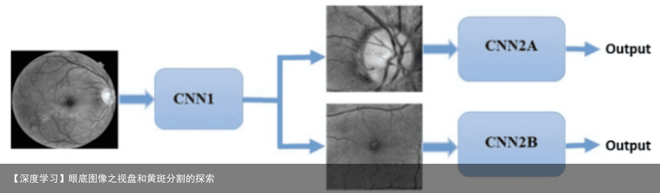 【深度学习】眼底图像之视盘和黄斑分割的探索