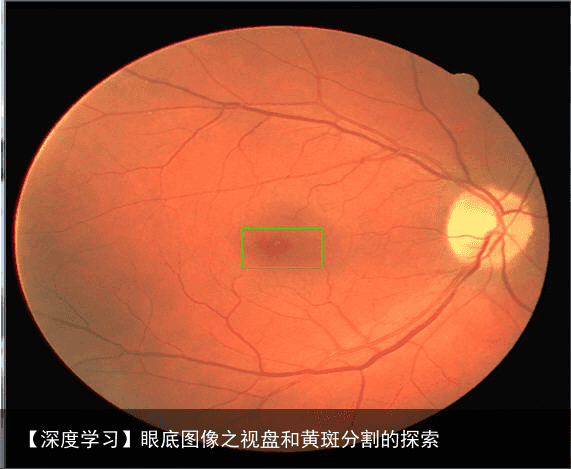 【深度学习】眼底图像之视盘和黄斑分割的探索