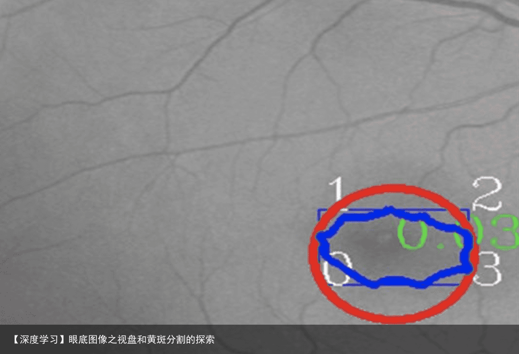 【深度学习】眼底图像之视盘和黄斑分割的探索