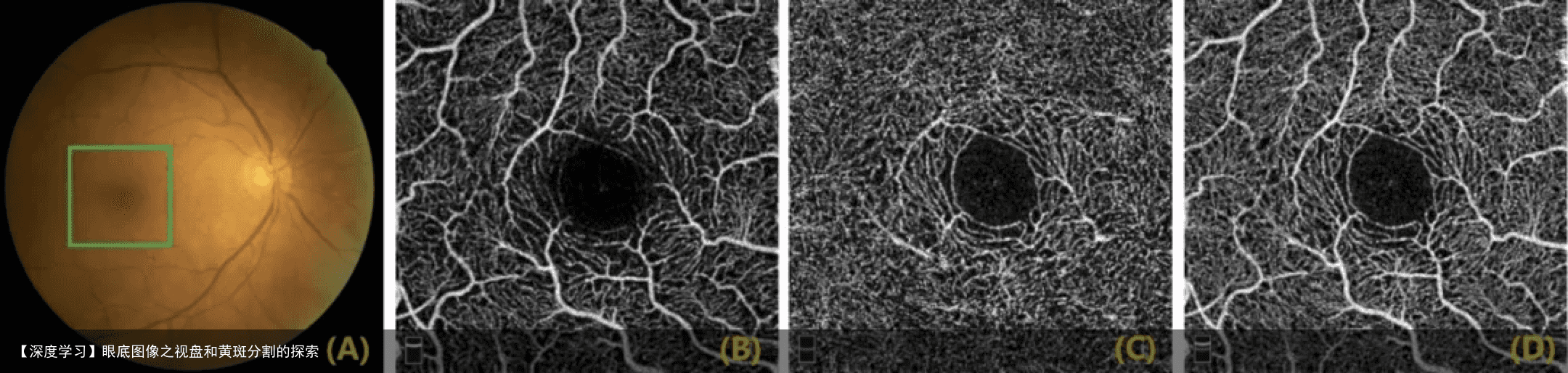 【深度学习】眼底图像之视盘和黄斑分割的探索