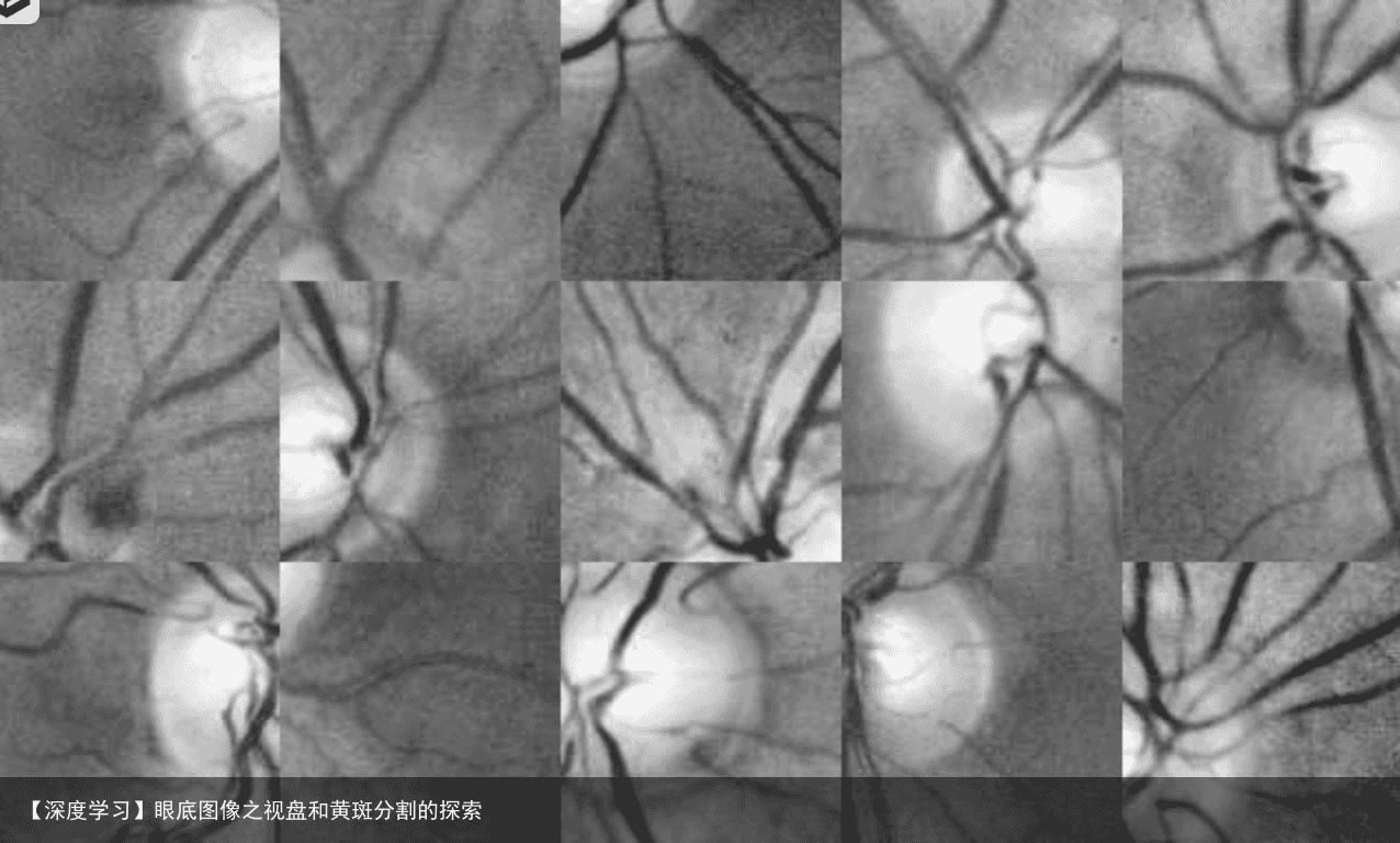 【深度学习】眼底图像之视盘和黄斑分割的探索