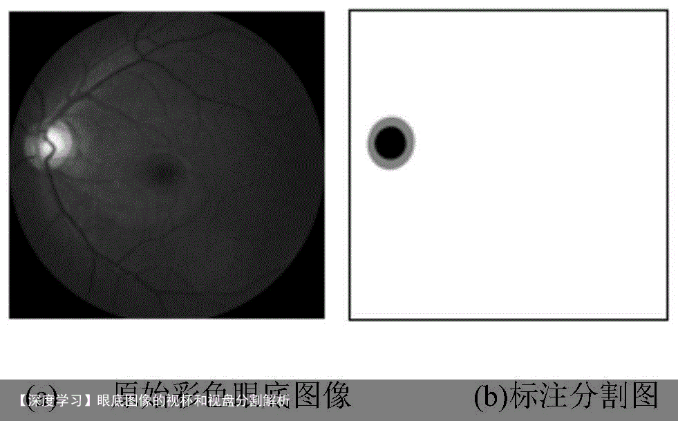 【深度学习】眼底图像的视杯和视盘分割解析1