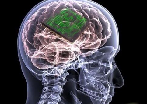 微软宣布重要消息 脑植入技术或取巨大进展2