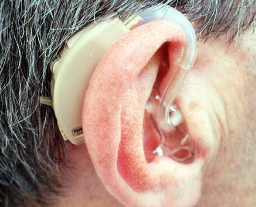 3D打印可用于打印骨头 将会有效解决听力障碍问题